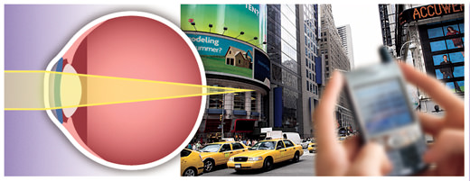 Hypermetropia (far- or long-sighted)
